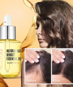 ODEIUN™ Grows Hair Oil