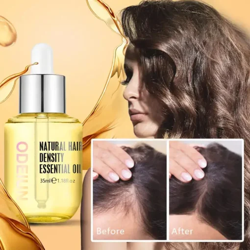 ODEIUN™ Grows Hair Oil