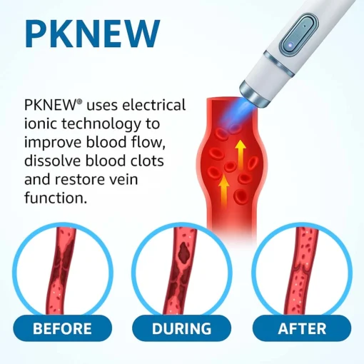 PKNEW® 𝗡𝗼𝗻-𝗜𝗻𝘃𝗮𝘀𝗶𝘃𝗲 Varicose Veins Treatment Laser Pen