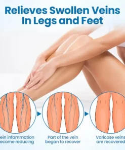 PKNEW® 𝗡𝗼𝗻-𝗜𝗻𝘃𝗮𝘀𝗶𝘃𝗲 Varicose Veins Treatment Laser Pen