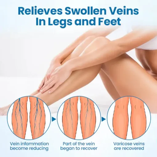 PKNEW® 𝗡𝗼𝗻-𝗜𝗻𝘃𝗮𝘀𝗶𝘃𝗲 Varicose Veins Treatment Laser Pen