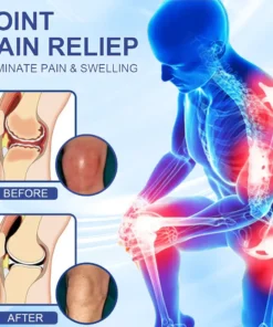Skavix® Advanced Magnesium Pain Relief Cream