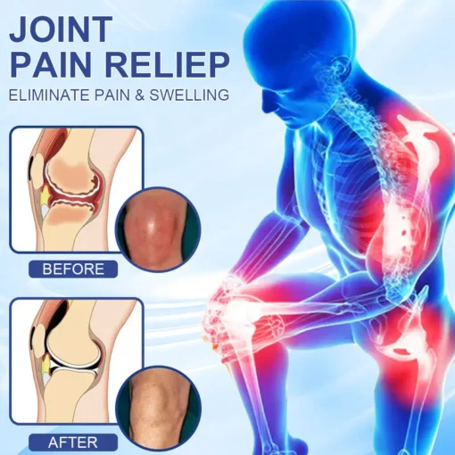 Skavix® Advanced Magnesium Pain Relief Cream