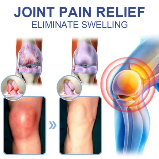 Skavix® Advanced Magnesium Pain Relief Cream