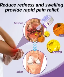 ODEIUN™ Turmeric & Emu Oil Arthritis Soothing Pain Relief Massage Gel