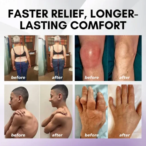 ODEIUN™ Turmeric & Emu Oil Arthritis Soothing Pain Relief Massage Gel