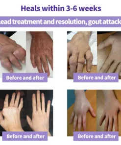 ODEIUN™ Turmeric & Emu Oil Arthritis Soothing Pain Relief Massage Gel
