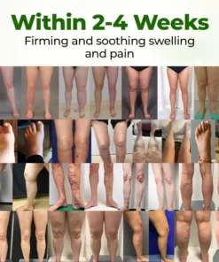 ODALIT® Professional Leg Circulation Cream