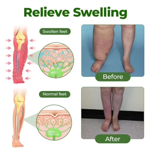 ODALIT® Professional Leg Circulation Cream