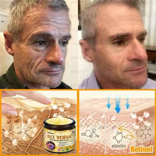 ODEIUN® 𝖡𝖾𝖾 𝗏𝖾𝗇𝗈𝗆 𝖲𝗄𝗂𝗇 𝖱𝖾𝗌𝗍𝗈𝗋𝖺𝗍𝗂𝗈𝗇 𝖢𝗋𝖾𝖺𝗆