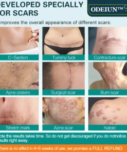 ODEIUN™ Advanced Scar Spray