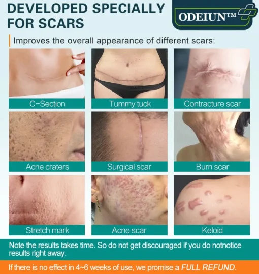 ODEIUN™ Advanced Scar Spray