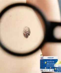 ODEIUN® BeeDerm RX Cream