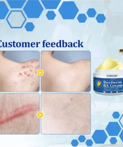 ODEIUN® BeeDerm RX Cream