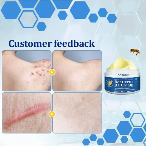 ODEIUN® BeeDerm RX Cream