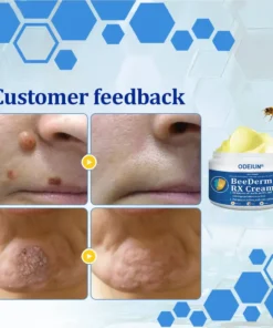 ODEIUN® BeeDerm RX Cream