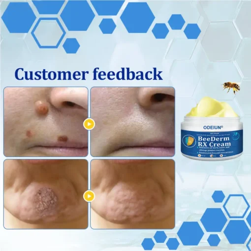 ODEIUN® BeeDerm RX Cream