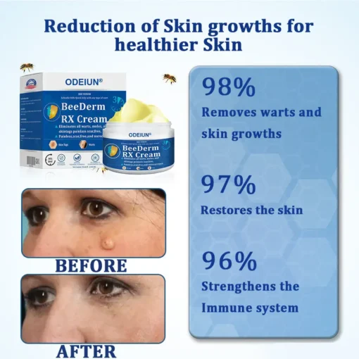ODEIUN® BeeDerm RX Cream