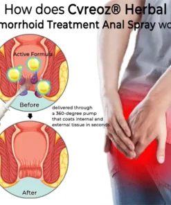 ODEIUN® Hemorrhoid Relief Spray