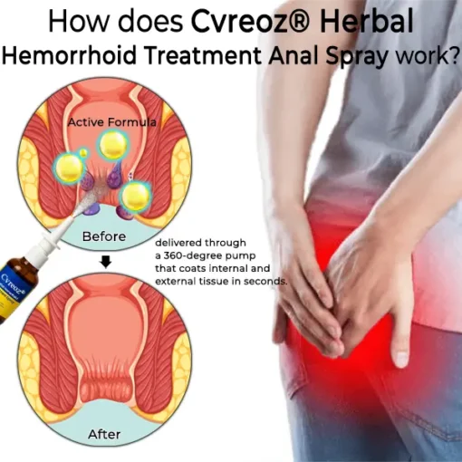 ODEIUN® Hemorrhoid Relief Spray