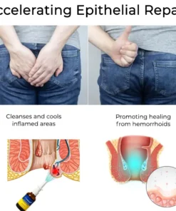 ODEIUN® Hemorrhoid Relief Spray