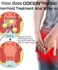 ODEIUN® Hemorrhoid Relief Spray