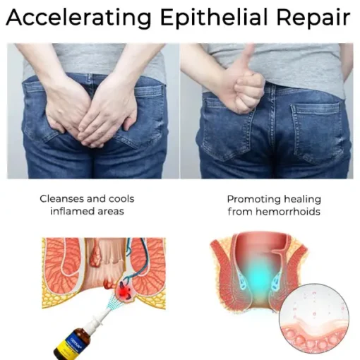 ODEIUN® Hemorrhoid Relief Spray