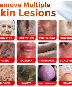 ODEIUN® MicroNeedle Botanic Skin Tag Removal Patch