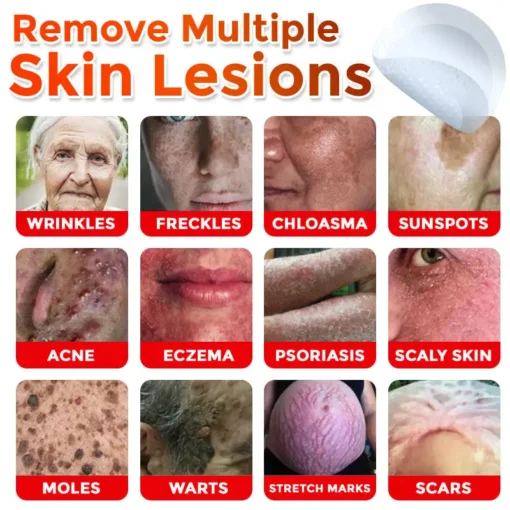 ODEIUN® MicroNeedle Botanic Skin Tag Removal Patch