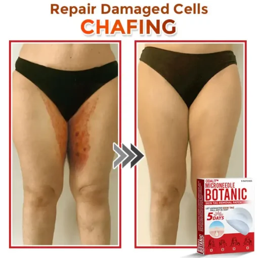 ODEIUN® MicroNeedle Botanic Skin Tag Removal Patch