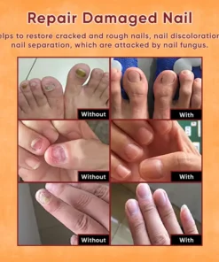 ODEIUN™ Nails Repair Serum