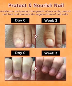 ODEIUN™ Nails Repair Serum