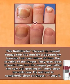 ODEIUN™ Nails Repair Serum