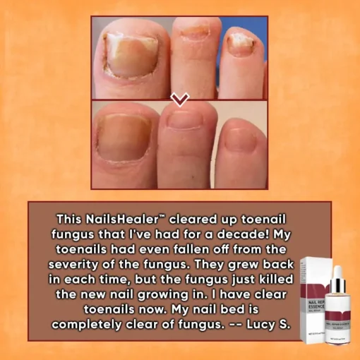 ODEIUN™ Nails Repair Serum