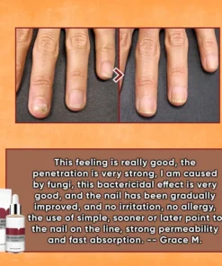 ODEIUN™ Nails Repair Serum