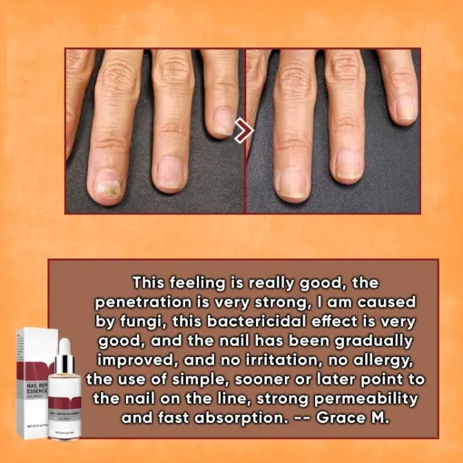 ODEIUN™ Nails Repair Serum