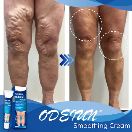ODEIUN™ Smoothing Cream