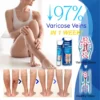 ODEIUN™ Varicose & Spider Vein Cream