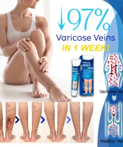 ODEIUN™ Varicose & Spider Vein Cream