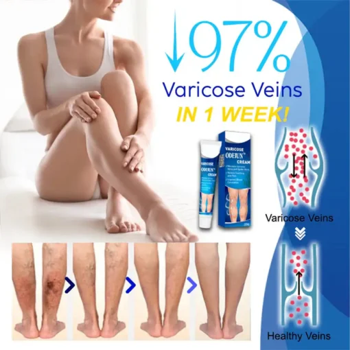ODEIUN™ Varicose & Spider Vein Cream