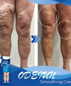 ODEIUN™ Varicose & Spider Vein Cream