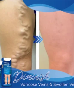ODEIUN™ Varicose & Spider Vein Cream