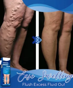 ODEIUN™ Varicose & Spider Vein Cream