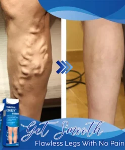 ODEIUN™ Varicose & Spider Vein Cream