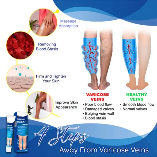 ODEIUN™ Varicose & Spider Vein Cream