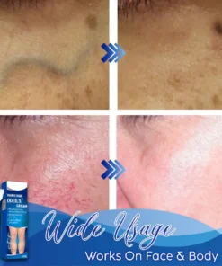 ODEIUN™ Varicose & Spider Vein Cream