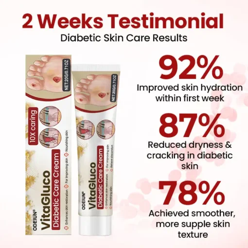 ODEIUN® VitaGluco Diabetic Care Cream