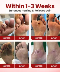 ODEIUN® VitaGluco Diabetic Care Cream