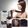Odeiun™ Natural Hair Regrowth Spray