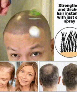 Odeiun™ Natural Hair Regrowth Spray